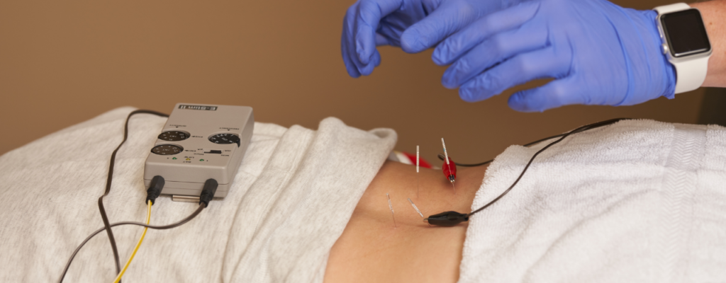 Dry Needling Elevate Physical Therapy